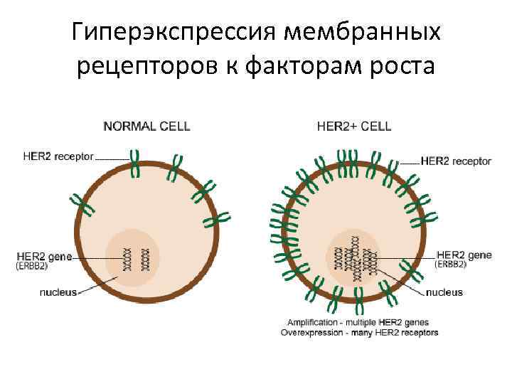 Гиперэкспрессия мембранных рецепторов к факторам роста 