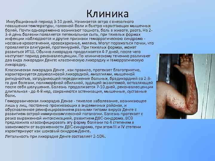 Клиника Инкубационный период 3 -10 дней. Начинается остро с внезапного повышения температуры, головной боли