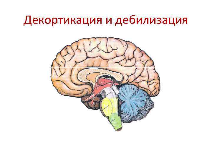 Декортикация и дебилизация 