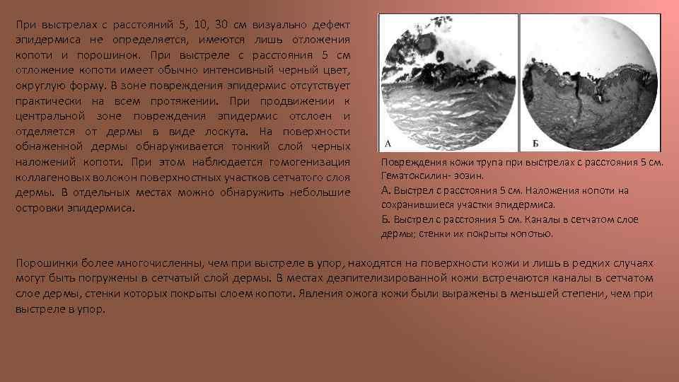 При выстрелах с расстояний 5, 10, 30 см визуально дефект эпидермиса не определяется, имеются