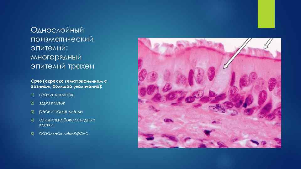 Однослойный призматический эпителий: многорядный эпителий трахеи Срез (окраска гематоксилином с эозином, большое увеличение): 1)