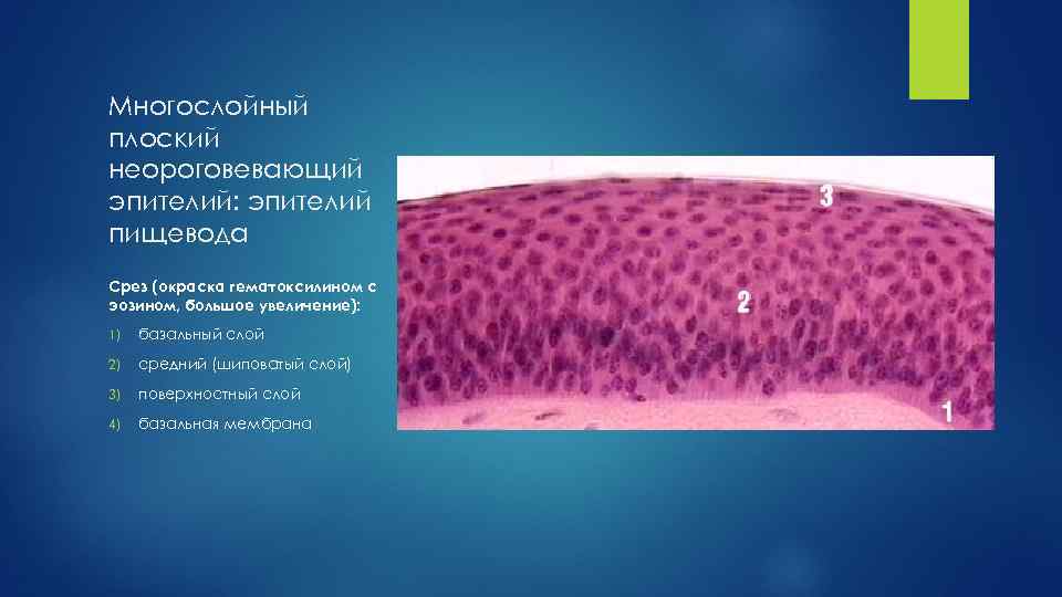 Многослойный плоский неороговевающий эпителий: эпителий пищевода Срез (окраска гематоксилином с эозином, большое увеличение): 1)