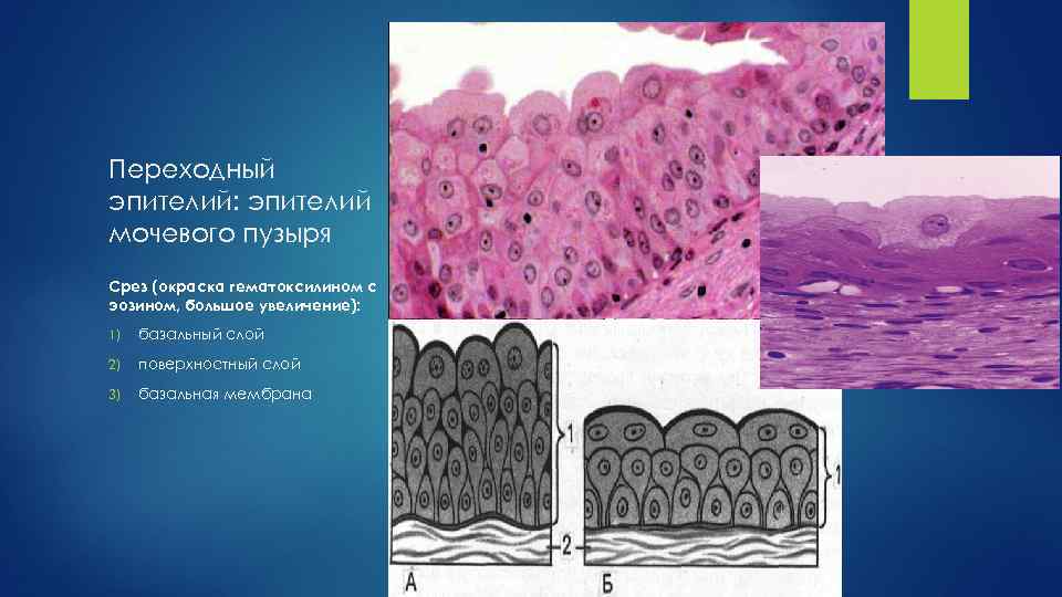 Переходный эпителий: эпителий мочевого пузыря Срез (окраска гематоксилином с эозином, большое увеличение): 1) базальный