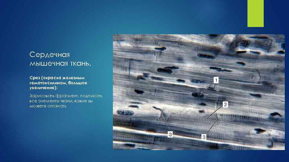 Сердечная мышечная ткань. Срез (окраска железным гематоксилином, большое увеличение): Зарисовать фрагмент, подписать все элементы