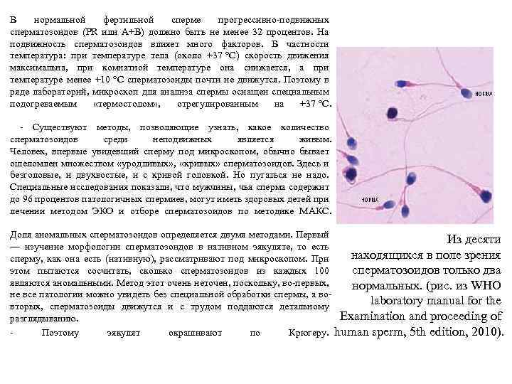 В нормальной фертильной сперме прогрессивно-подвижных сперматозоидов (PR или A+B) должно быть не менее 32