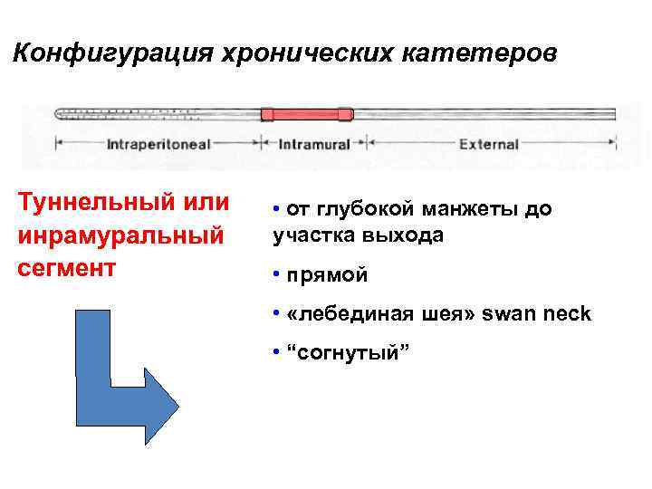 Конфигурация хронических катетеров Туннельный или инрамуральный сегмент • oт глубокой манжеты до участка выхода