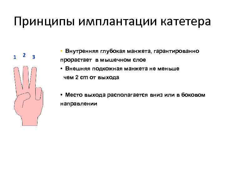 Принципы имплантации катетера 1 2 3 • Внутренняя глубокая манжета, гарантированно прорастает в мышечном