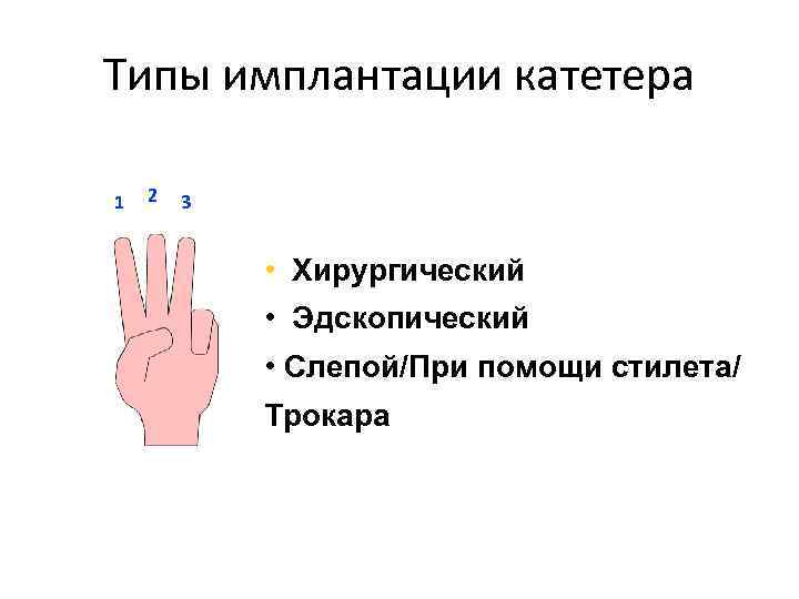 Типы имплантации катетера 1 2 3 • Хирургический • Эдскопический • Слепой/При помощи стилета/