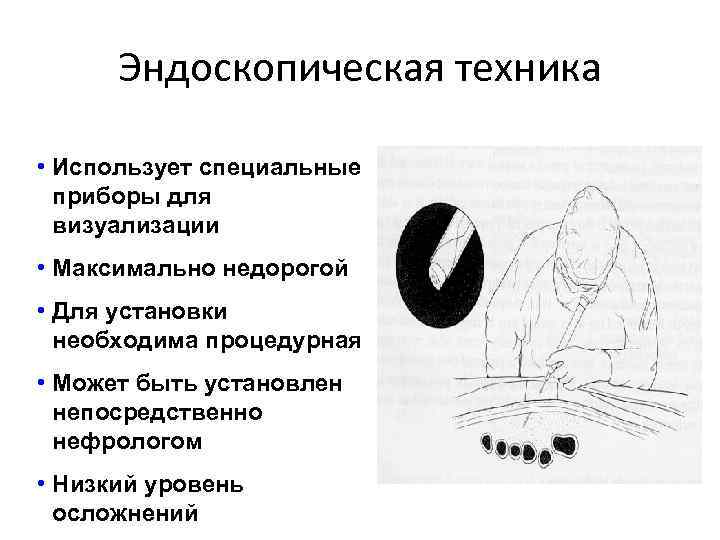 Эндоскопическая техника • Использует специальные приборы для визуализации • Максимально недорогой • Для установки