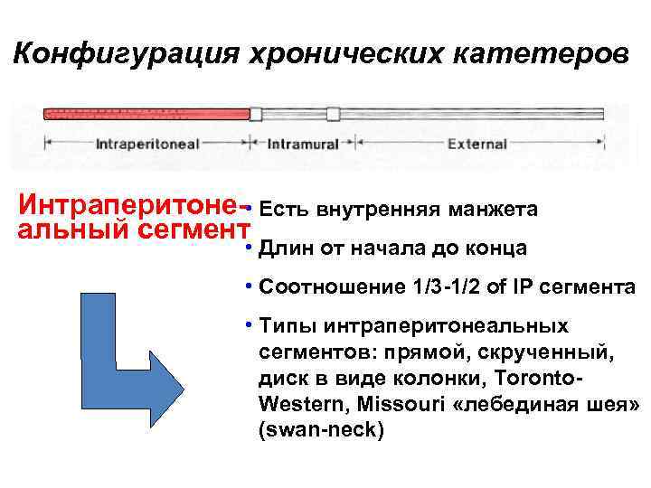 Конфигурация хронических катетеров Интраперитоне- • Есть внутренняя манжета альный сегмент • Длин от начала