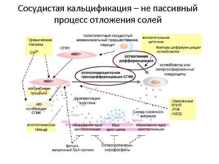 Сосудистая кальцификация – не пассивный процесс отложения солей 