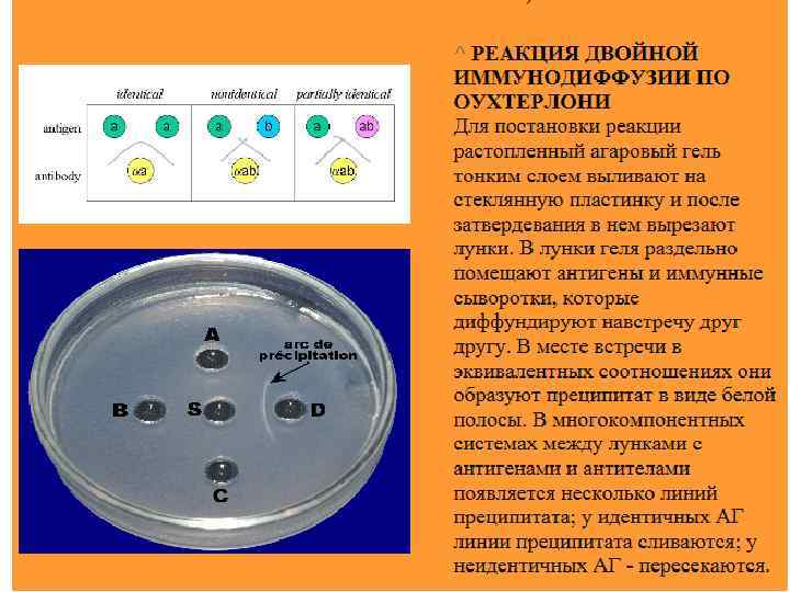Реакция двойной иммунодиффузии по оухтерлони картинки