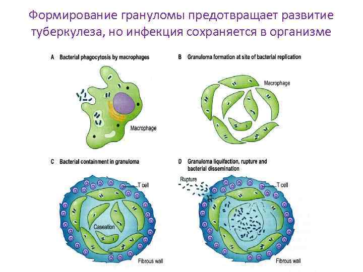 Формирование грануломы предотвращает развитие туберкулеза, но инфекция сохраняется в организме 