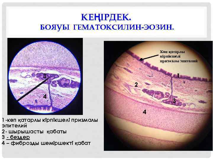 КЕҢІРДЕК. БОЯУЫ ГЕМАТОКСИЛИН-ЭОЗИН. Көп қатарлы кірпікшелі призмалы эпителий 1 3 2 4 3 4