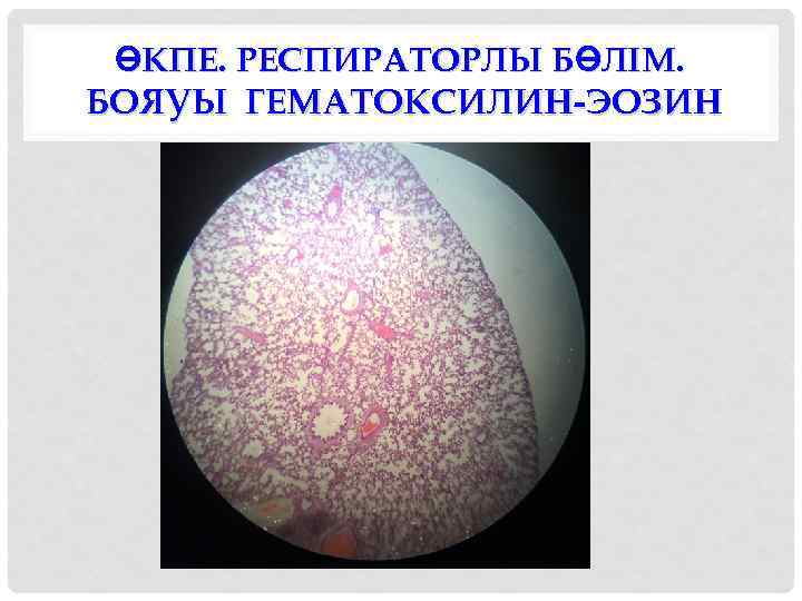 ӨКПЕ. РЕСПИРАТОРЛЫ БӨЛІМ. БОЯУЫ ГЕМАТОКСИЛИН-ЭОЗИН 