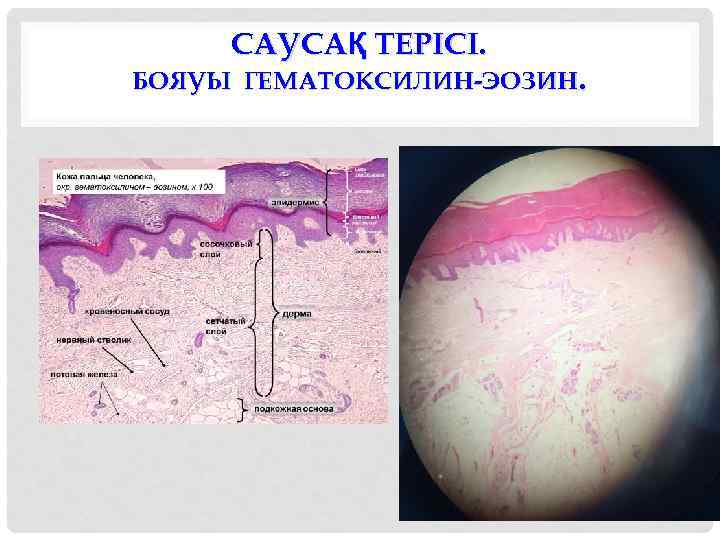САУСАҚ ТЕРІСІ. БОЯУЫ ГЕМАТОКСИЛИН-ЭОЗИН. 