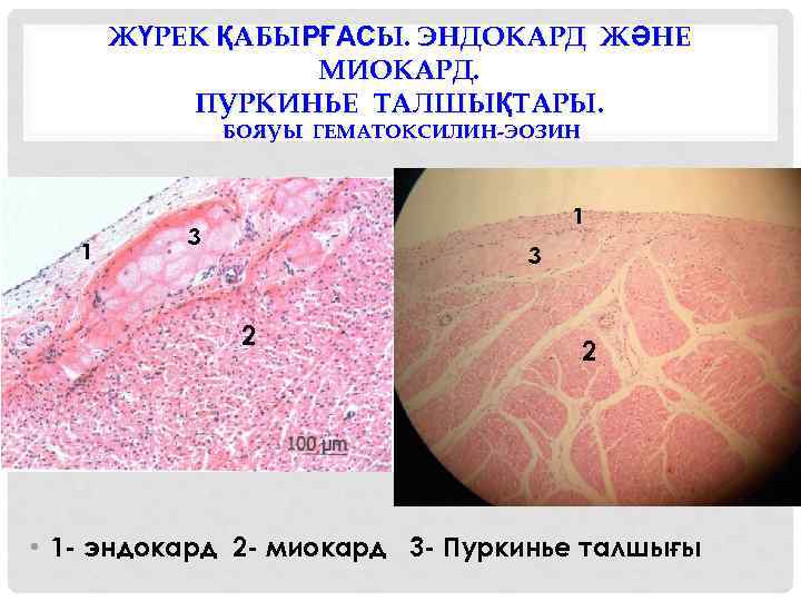 ЖҮРЕК ҚАБЫРҒАСЫ. ЭНДОКАРД ЖӘНЕ МИОКАРД. ПУРКИНЬЕ ТАЛШЫҚТАРЫ. БОЯУЫ ГЕМАТОКСИЛИН-ЭОЗИН 1 1 3 3 2