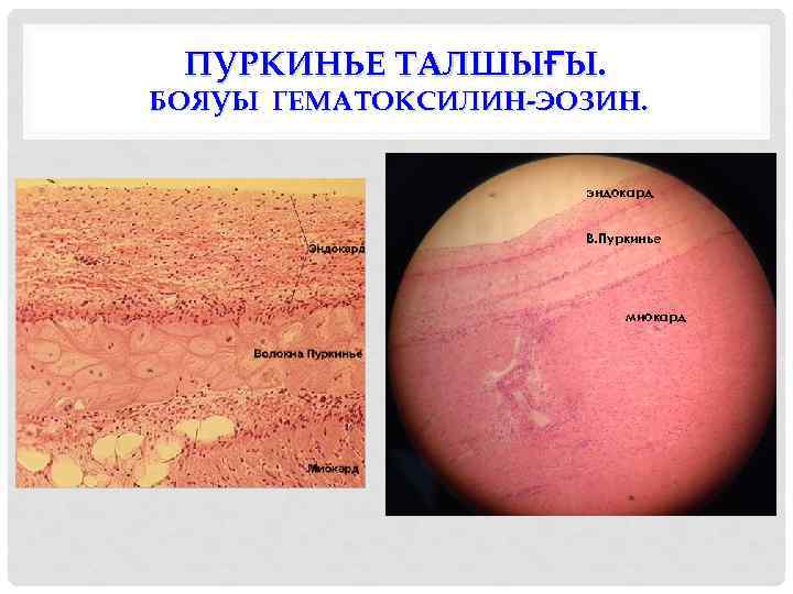 ПУРКИНЬЕ ТАЛШЫҒЫ. БОЯУЫ ГЕМАТОКСИЛИН-ЭОЗИН. эндокард В. Пуркинье миокард 