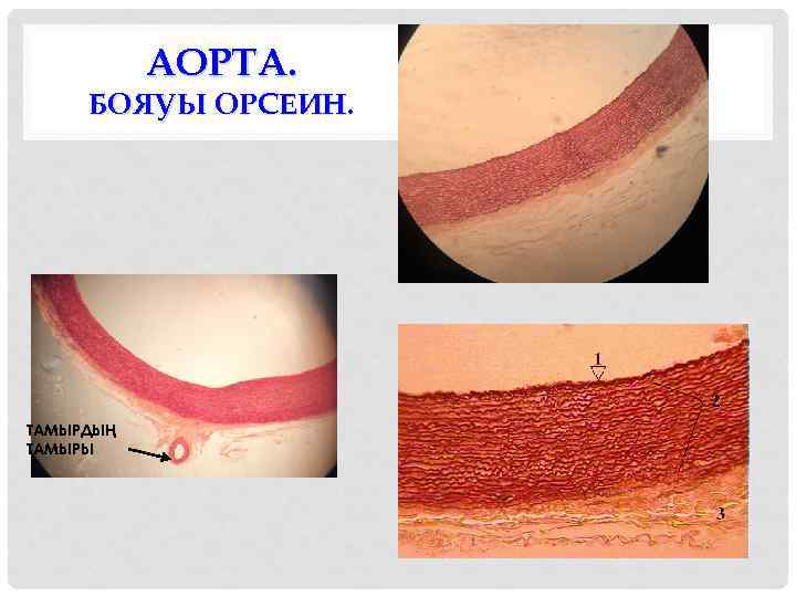 АОРТА. БОЯУЫ ОРСЕИН. ТАМЫРДЫҢ ТАМЫРЫ 