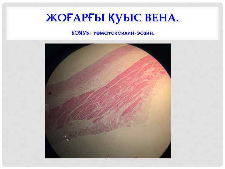 ЖОҒАРҒЫ ҚУЫС ВЕНА. БОЯУЫ гематоксилин-эозин. 