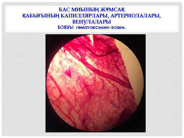БАС МИЫНЫҢ ЖҰМСАҚ ҚАБЫҒЫНЫҢ КАПИЛЛЯРЛАРЫ, АРТЕРИОЛАЛАРЫ, ВЕНУЛАЛАРЫ БОЯУЫ гематоксилин-эозин. 