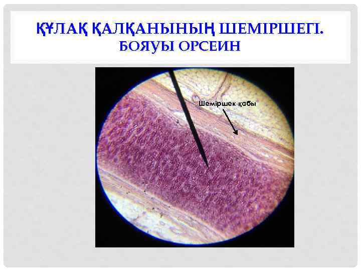 ҚҰЛАҚ ҚАЛҚАНЫНЫҢ ШЕМІРШЕГІ. БОЯУЫ ОРСЕИН Шеміршек қабы 