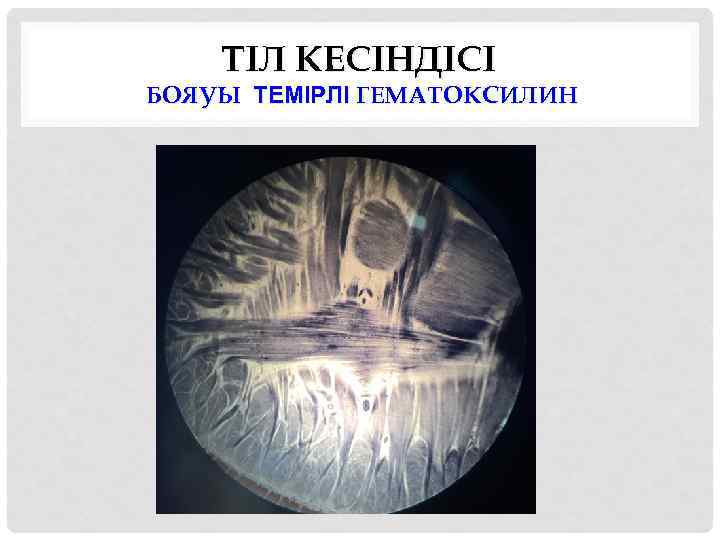 ТІЛ КЕСІНДІСІ БОЯУЫ ТЕМІРЛІ ГЕМАТОКСИЛИН 