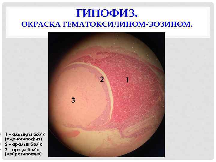 ГИПОФИЗ. ОКРАСКА ГЕМАТОКСИЛИНОМ-ЭОЗИНОМ. • 1 – алдыңғы бөлік (аденогипофиз) • 2 – аралық бөлік