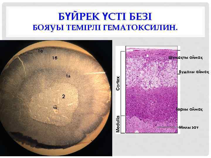 БҮЙРЕК ҮСТІ БЕЗІ БОЯУЫ ТЕМІРЛІ ГЕМАТОКСИЛИН. 1 а Шумақты аймақ 1 б 1 в