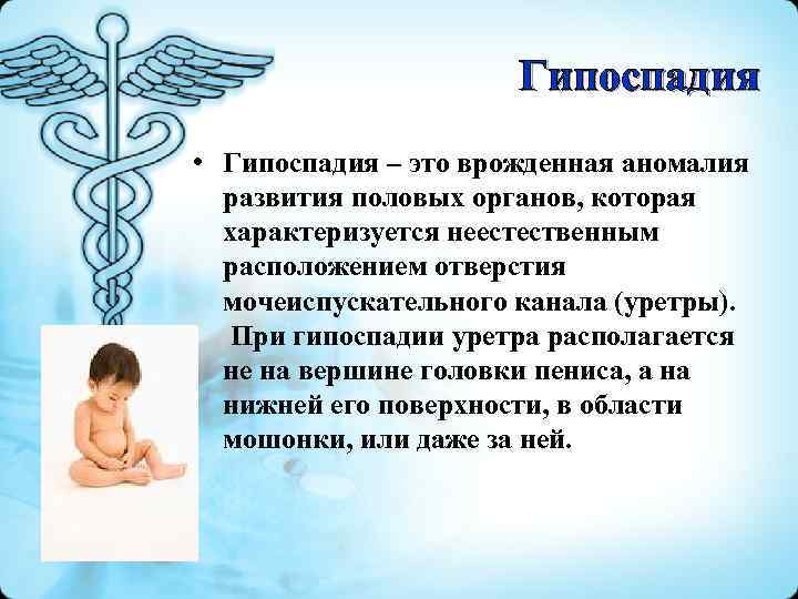 Гипоспадия • Гипоспадия – это врожденная аномалия развития половых органов, которая характеризуется неестественным расположением