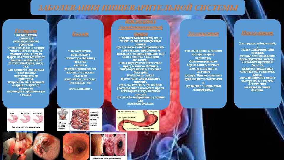 ЗАБОЛЕВАНИЯ ПИЩЕВАРИТЕЛЬНОЙ СИСТЕМЫ Гастрит Это воспаление слизистой (или внутренней) оболочки стенок желудка. Гастрит может