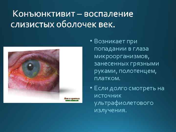  • Возникает при попадании в глаза микроорганизмов, занесенных грязными руками, полотенцем, платком. •