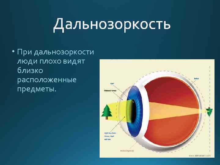  • При дальнозоркости люди плохо видят близко расположенные предметы. 