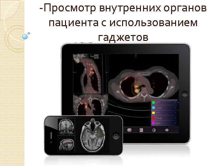 -Просмотр внутренних органов пациента с использованием гаджетов 