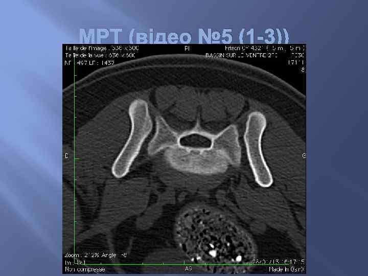 МРТ (відео № 5 (1 -3)) 