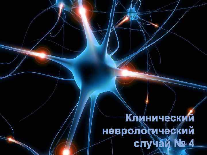 Клинический неврологический случай № 4 