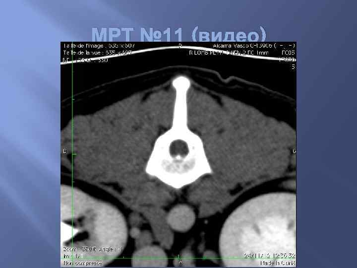 МРТ № 11 (видео) 
