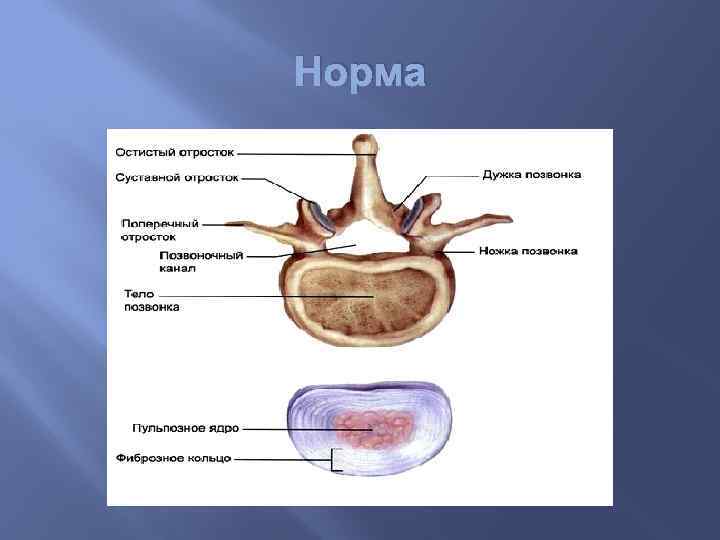 Норма 