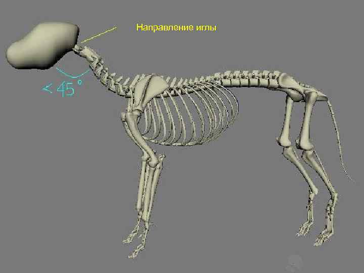 Направление иглы 