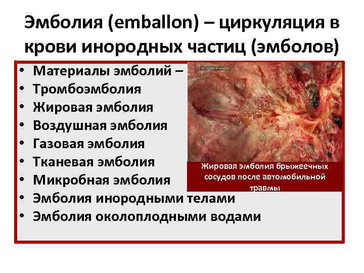 Эмболия (emballon) – циркуляция в крови инородных частиц (эмболов) • • • Материалы эмболий