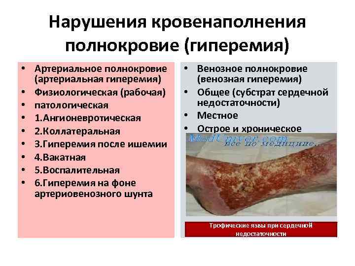 Нарушения кровенаполнения полнокровие (гиперемия) • Артериальное полнокровие (артериальная гиперемия) • Физиологическая (рабочая) • патологическая