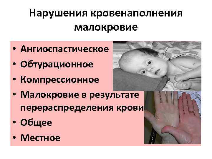 Нарушения кровенаполнения малокровие Ангиоспастическое Обтурационное Компрессионное Малокровие в результате перераспределения крови • Общее •