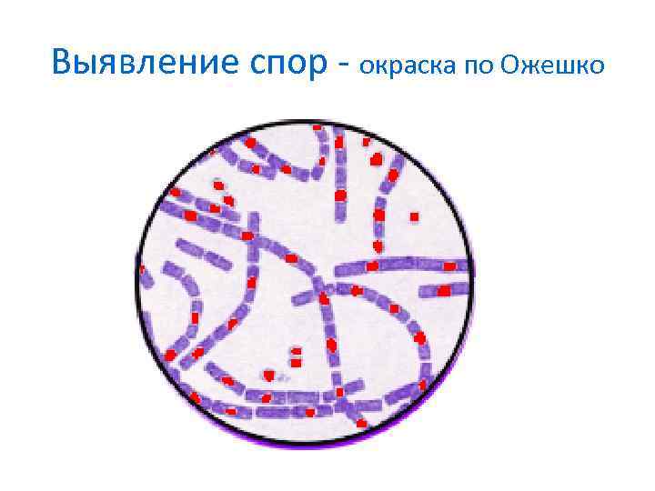 Выявление спор - окраска по Ожешко 