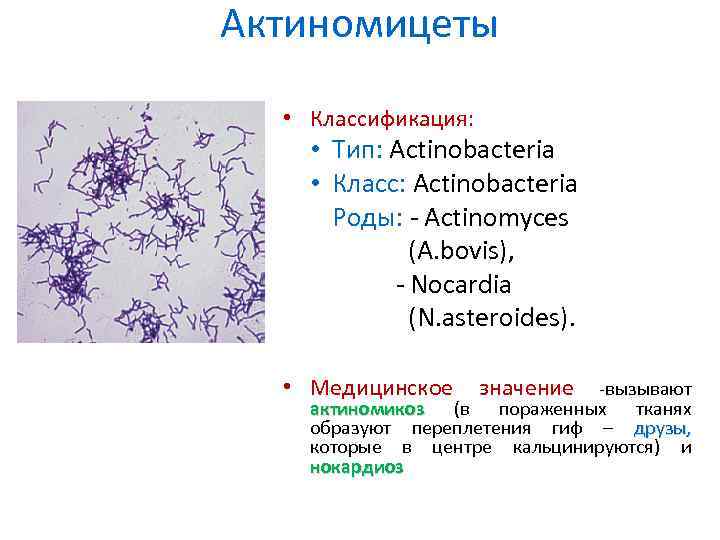 Актиномицеты • Классификация: • Тип: Actinobacteria • Класс: Actinobacteria Роды: - Actinomyces (A. bovis),