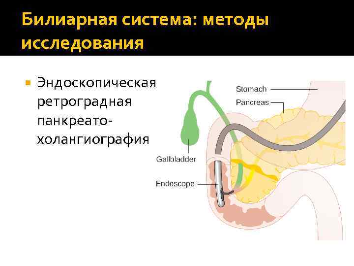 Билиарная система: методы исследования Эндоскопическая ретроградная панкреатохолангиография 