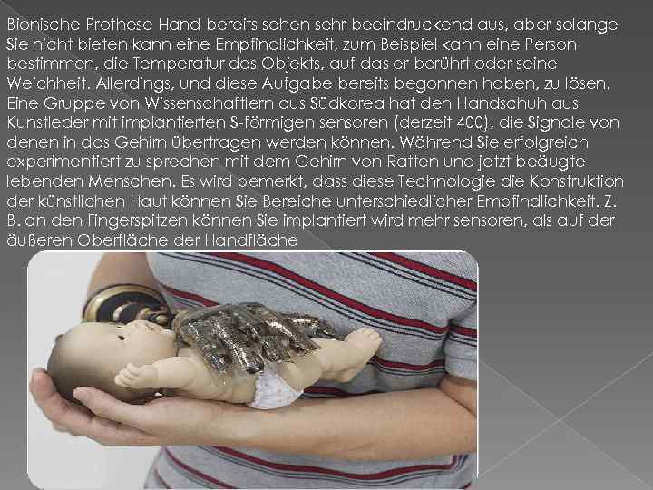 Bionische Prothese Hand bereits sehen sehr beeindruckend aus, aber solange Sie nicht bieten kann