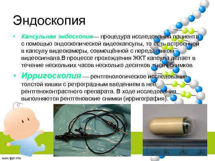 Капсульная эндоскопия презентация