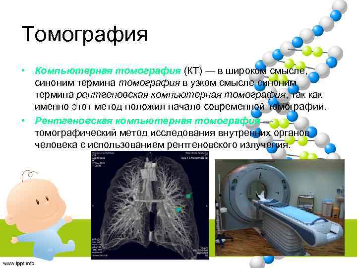 Томография • Компьютерная томография (КТ) — в широком смысле, синоним термина томография в узком