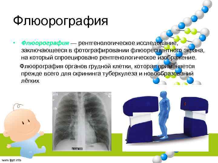 Флг что это в медицине. Подготовка пациента к флюорографии. Флюорография ударение. Система рентгеновская скрининговая для органов грудной клетки. Флюорография картинки для презентации.