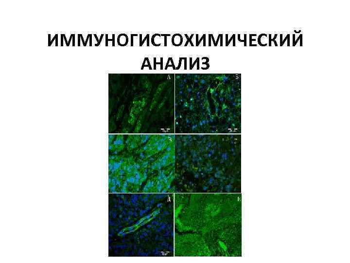 ИММУНОГИСТОХИМИЧЕСКИЙ АНАЛИЗ 